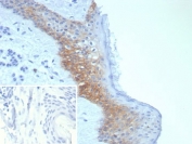 IHC staining of FFPE human skin tissue with Desmoglein-3 antibody (clone DSG3/8252R). Inset: PBS used in place of primary Ab (secondary Ab negative control). HIER: boil tissue sections in pH 9 10mM Tris with 1mM EDTA for 20 min and allow to cool before testing.