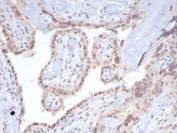 IHC staining of FFPE human pancreas tissue with SMAD4 antibody (clone SMAD4/7901). HIER: boil tissue sections in pH 9 10mM Tris with 1mM EDTA for 20 min and allow to cool before testing.