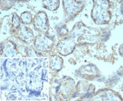 IHC staining of FFPE human placental tissue with CD147 antibody (clone BSG/7953) at 2ug/ml. Inset: PBS used in place of primary Ab (secondary Ab negative control). HIER: boil tissue sections in pH 9 10mM Tris with 1mM EDTA for 20 min and allow to cool before testing.