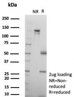 SDS-PAGE analysis of purified, BSA-free recombinant SMAD4 antibody (clone SMAD4/7906R) as confirmation of integrity and purity.