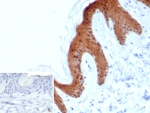 IHC staining of FFPE human skin tissue with MASPIN antibody (clone SERPINB5/4978). Inset: PBS used in place of primary Ab (secondary Ab negative control). HIER: boil tissue sections in pH 9 10mM Tris with 1mM EDTA for 20 min and allow to cool before testing.