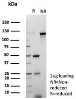SDS-PAGE analysis of purified, BSA-free Bcl-2 antibody (clone BCL2/6915) as confirmation of integrity and purity.