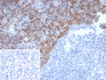 IHC staining of FFPE human tonsil tissue with Bcl-2 antibody (clone BCL2/6915). Inset: PBS used in place of primary Ab (secondary Ab negative control). HIER: boil tissue sections in pH 9 10mM Tris with 1mM EDTA for 20 min and allow to cool before testing.