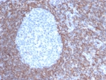 IHC staining of FFPE human tonsil tissue with Bcl-2 antibody (clone BCL2/6915). HIER: boil tissue sections in pH 9 10mM Tris with 1mM EDTA for 20 min and allow to cool before testing.