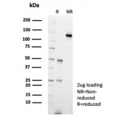 SDS-PAGE analysis of purified, BSA-free CARM1 antibody (clone CARM1/7426) as confirmation of integrity and purity.