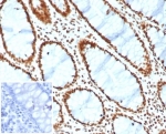 IHC staining of FFPE human colon tissue with SMARCA4 antibody (clone BRG1/6531R). Inset: PBS used in place of primary Ab (secondary Ab negative control). HIER: boil tissue sections in pH 9 10mM Tris with 1mM EDTA for 20 min and allow to cool before testing.