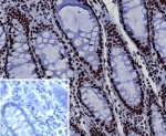 IHC staining of FFPE human colon tissue with BRG1 antibody (clone BRG1/7633R). Inset: PBS used in place of primary Ab (secondary Ab negative control). HIER: boil tissue sections in pH 9 10mM Tris with 1mM EDTA for 20 min and allow to cool before testing.