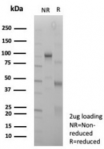 SDS-PAGE analysis of purified, BSA-free SMARCA4 antibody (clone BRG1/8805R) as confirmation of integrity and purity.