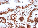 IHC staining of FFPE human colon tissue with SMARCA4 antibody (clone BRG1/8805R). HIER: boil tissue sections in pH 9 10mM Tris with 1mM EDTA for 20 min and allow to cool before testing.