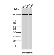 SMARCA4 Antibody Cell Line WB. Western blot analysis of SMARCA4 expression in HeLa, Jurkat, and K562 cell lysates using SMARCA4 antibody clone BRG1/8805R. A band is detected at approximately 190-200 kDa, consistent with the predicted molecular weight of SMARCA4.