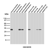 Calponin 1 Antibody Multi-Species Intestine and Lung WB. Western blot analysis of human intestine lysate, mouse intestine lysate, rat intestine lysate, hamster intestine lysate, guinea pig intestine lysate, rabbit intestine lysate, human lung lysate, mouse lung lysate, rat lung lysate, hamster lung lysate, guinea pig lung lysate, and rabbit lung lysate using Calponin 1 antibody. The recombinant rabbit monoclonal antibody clone CNN1/8870R detects a band at approximately 34 kDa, consistent with the predicted molecular weight of Calponin 1 / CNN1. Signal is observed across intestine and lung samples from multiple species, reflecting expression of this smooth muscle-associated contractile protein in tissues containing smooth muscle components.
