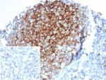 IHC staining of FFPE human tonsil tissue with CD23 antibody; Membrane staining observed with FCER2/6889 mAb at 2ug/ml. Inset: PBS used in place of primary Ab (secondary Ab negative control). HIER: boil tissue sections in pH 9 10mM Tris with 1mM EDTA for 20 min and allow to cool before testing.