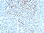 IHC staining of FFPE human tonsil. Membrane stained using FCER2/6893 at 2ug/ml. Inset: PBS used in place of primary Ab (secondary Ab negative control). HIER: boil tissue sections in pH 9 10mM Tris with 1mM EDTA for 20 min and allow to cool before testing.
