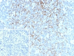 IHC staining of FFPE human tonsil. Membrane stained using FCER2/6893 at 2ug/ml. Inset: PBS used in place of primary Ab (secondary Ab negative control). HIER: boil tissue sections in pH 9 10mM Tris with 1mM EDTA for 20 min and allow to cool before testing.