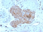 IHC staining of FFPE human testis tissue with Anti-Mullerian Hormone antibody (clone AMH/7354). HIER: boil tissue sections in pH 9 10mM Tris with 1mM EDTA for 20 min and allow to cool before testing.