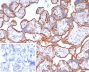 IHC staining of FFPE human placental tissue with CD147 antibody (clone BSG/7951) at 2ug/ml. Inset: PBS used in place of primary Ab (secondary Ab negative control). HIER: boil tissue sections in pH 9 10mM Tris with 1mM EDTA for 20 min and allow to cool before testing.