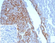 IHC staining of FFPE human tonsil tissue with CD23 antibody (clone FCER2/8234R). Inset: PBS used in place of primary Ab (secondary Ab negative control). HIER: boil tissue sections in pH 9 10mM Tris with 1mM EDTA for 20 min and allow to cool before testing.
