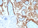 IHC staining of FFPE human placental tissue with EBI3 antibody (clone EBI3/8902). Inset: PBS used in place of primary Ab (secondary Ab negative control). HIER: boil tissue sections in pH 9 10mM Tris with 1mM EDTA for 20 min and allow to cool before testing.