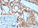IHC staining of FFPE human placental tissue with EBI3 antibody (clone EBI3/8903). Inset: PBS used in place of primary Ab (secondary Ab negative control). HIER: boil tissue sections in pH 9 10mM Tris with 1mM EDTA for 20 min and allow to cool before testing.