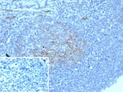 IHC staining of FFPE human tonsil tissue with recombinant CD54 antibody (clone ICAM1/8677R). Inset: PBS used in place of primary Ab (secondary Ab negative control). HIER: boil tissue sections in pH 9 10mM Tris with 1mM EDTA for 20 min and allow to cool before testing.