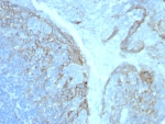 IHC staining of FFPE human tonsil tissue with CD54 / ICAM-1 antibody (clone ICAM1/8247R). HIER: boil tissue sections in pH 9 10mM Tris with 1mM EDTA for 20 min and allow to cool before testing.