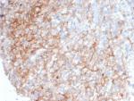 IHC staining of FFPE human tonsil tissue with ICAM-1 antibody (clone ICAM1/6968). HIER: boil tissue sections in pH 9 10mM Tris with 1mM EDTA for 20 min and allow to cool before testing.