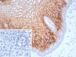 IHC staining of FFPE human esophagus tissue with SBSN antibody (clone SBSN/7963). Inset: PBS used in place of primary Ab (secondary Ab negative control). HIER: boil tissue sections in pH 9 10mM Tris with 1mM EDTA for 20 min and allow to cool before testing.