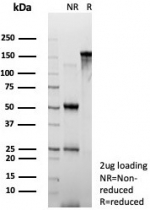 SDS-PAGE analysis of purified, BSA-free Suprabasin antibody (clone SBSN/7965) as confirmation of integrity and purity.