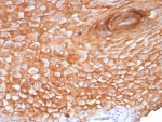 IHC staining of FFPE human skin tissue with Suprabasin antibody (clone SBSN/7965). HIER: boil tissue sections in pH 9 10mM Tris with 1mM EDTA for 20 min and allow to cool before testing.