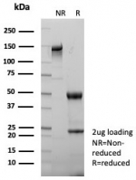 SDS-PAGE analysis of purified, BSA-free TGFB antibody (clone TGFB/7230) as confirmation of integrity and purity.