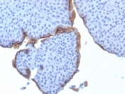 IHC staining of FFPE human bladder tissue with UPK3B antibody (clone UPK3B/3270). HIER: boil tissue sections in pH 9 10mM Tris with 1mM EDTA for 20 min and allow to cool before testing.