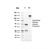 SDS-PAGE analysis of purified, BSA-free UPK3B antibody (clone UPK3B/3270) as confirmation of integrity and purity.