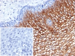 IHC staining of FFPE human esophagus tissue with Suprabasin antibody (clone SBSN/7964). Inset: PBS used in place of primary Ab (secondary Ab negative control). HIER: boil tissue sections in pH 9 10mM Tris with 1mM EDTA for 20 min and allow to cool before testing.