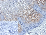 IHC staining of FFPE human esophagus tissue with SBSN antibody (clone SBSN/7961). Inset: PBS used in place of primary Ab (secondary Ab negative control). HIER: boil tissue sections in pH 9 10mM Tris with 1mM EDTA for 20 min and allow to cool before testing.