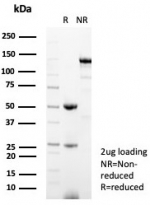 SDS-PAGE analysis of purified, BSA-free Kallikrein 5 antibody (clone KLK5/4760) as confirmation of integrity and purity.