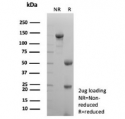 SDS-PAGE analysis of purified, BSA-free Uroplakin 3B antibody (clone UPK3B/8768R) as confirmation of integrity and purity.