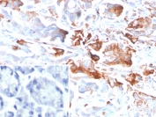 IHC staining of FFPE human stomach tissue with CEACAM1 antibody (clone CEACAM1/4840). Inset: PBS used in place of primary Ab (secondary Ab negative control). HIER: boil tissue sections in pH 9 10mM Tris with 1mM EDTA for 20 min and allow to cool before testing.