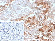 IHC staining of FFPE human stomach tissue with BGP-1 antibody (clone CEACAM1/4843). Inset: PBS used in place of primary Ab (secondary Ab negative control). HIER: boil tissue sections in pH 9 10mM Tris with 1mM EDTA for 20 min and allow to cool before testing.