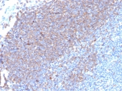 IHC staining of FFPE human tonsil tissue with CD79a antibody (clone rIGA/6986). HIER: boil tissue sections in pH 9 10mM Tris with 1mM EDTA for 20 min and allow to cool before testing.