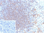IHC staining of FFPE human tonsil tissue with CD79a antibody (clone rIGA/6986). Inset: PBS used in place of primary Ab (secondary Ab negative control). HIER: boil tissue sections in pH 9 10mM Tris with 1mM EDTA for 20 min and allow to cool before testing.