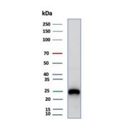 Western blot testing of human Daudi cell lysate with CD79a antibody (clone rIGA/6986). Expected molecular weight: 25-47 kDa depending on glycosylation level.