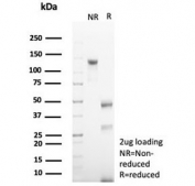 SDS-PAGE analysis of purified, BSA-free CD79a antibody (clone rIGA/6986) as confirmation of integrity and purity.