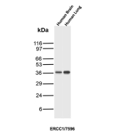 ERCC1 Antibody Brain and Lung WB. Western blot analysis of human brain and human lung tissue lysates using ERCC1 Antibody (clone ERCC1/7596) detects a band at approximately 35-40 kDa, consistent with the predicted molecular weight of ERCC1, with comparable expression observed across both tissues.