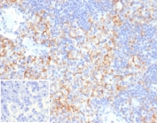 IHC staining of FFPE human lymph node tissue with SIGLEC3 antibody (clone SIGLEC3/3597). Inset: PBS used in place of primary Ab (secondary Ab negative control). HIER: boil tissue sections in pH 9 10mM Tris with 1mM EDTA for 20 min and allow to cool before testing.
