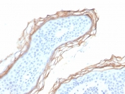IHC staining of FFPE human skin tissue with Kallikrein 5 antibody (clone KLK5/3855). HIER: boil tissue sections in pH 9 10mM Tris with 1mM EDTA for 20 min and allow to cool before testing.