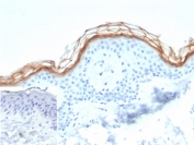 IHC staining of FFPE human skin tissue with KLK7 antibody (clone KLK7/4693). Inset: PBS used in place of primary Ab (secondary Ab negative control). HIER: boil tissue sections in pH 9 10mM Tris with 1mM EDTA for 20 min and allow to cool before testing.