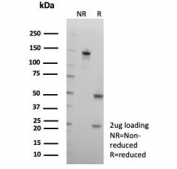 SDS-PAGE analysis of purified, BSA-free CD2 antibody (clone LFA2/8681R) as confirmation of integrity and purity.
