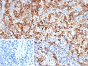 IHC staining of FFPE human spleen tissue with CD33 antibody (clone SIGLEC3/7612). Inset: PBS used in place of primary Ab (secondary Ab negative control). HIER: boil tissue sections in pH 9 10mM Tris with 1mM EDTA for 20 min and allow to cool before testing.