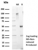 SDS-PAGE analysis of purified, BSA-free Prostate Specific Antigen antibody (clone rKLK3/6947) as confirmation of integrity and purity.