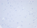 Negative control: IHC testing of FFPE human brain tissue with NAPSA antibody (clone NAPSA/7165R) at 2ug/ml. HIER: boil tissue sections in pH 9 10mM Tris with 1mM EDTA for 20 min and allow to cool before testing.